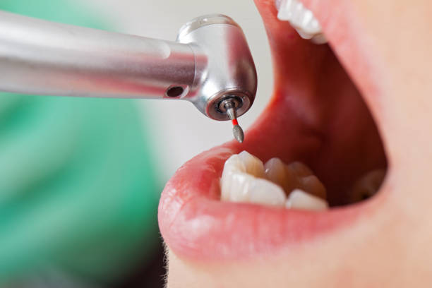 Best Cosmetic Emergency Dentistry in Urbana, IL